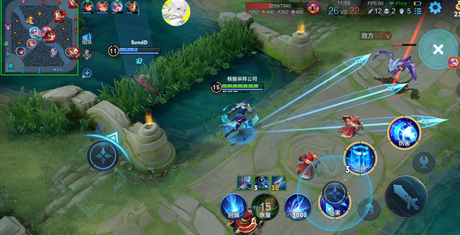 王者荣耀网易云辅助科技